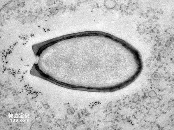 An unknown giant virus was discovered in permafrost dating back 30,000 years.