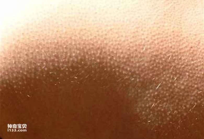 Ten "Legacy" of Human Evolution