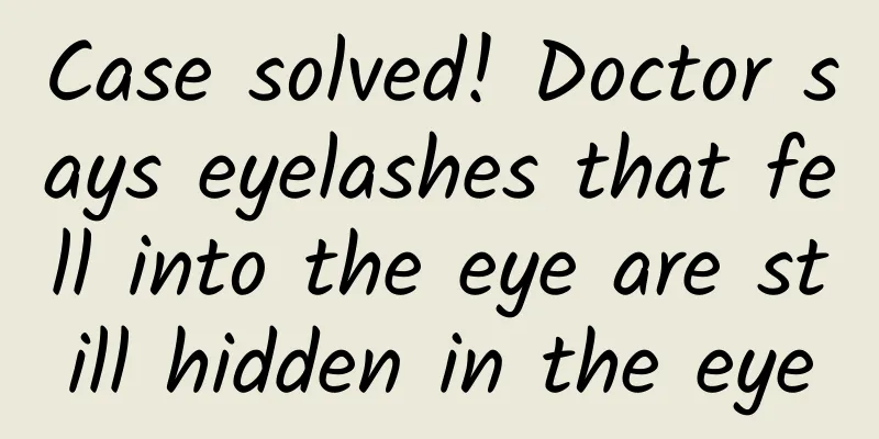 Case solved! Doctor says eyelashes that fell into the eye are still hidden in the eye
